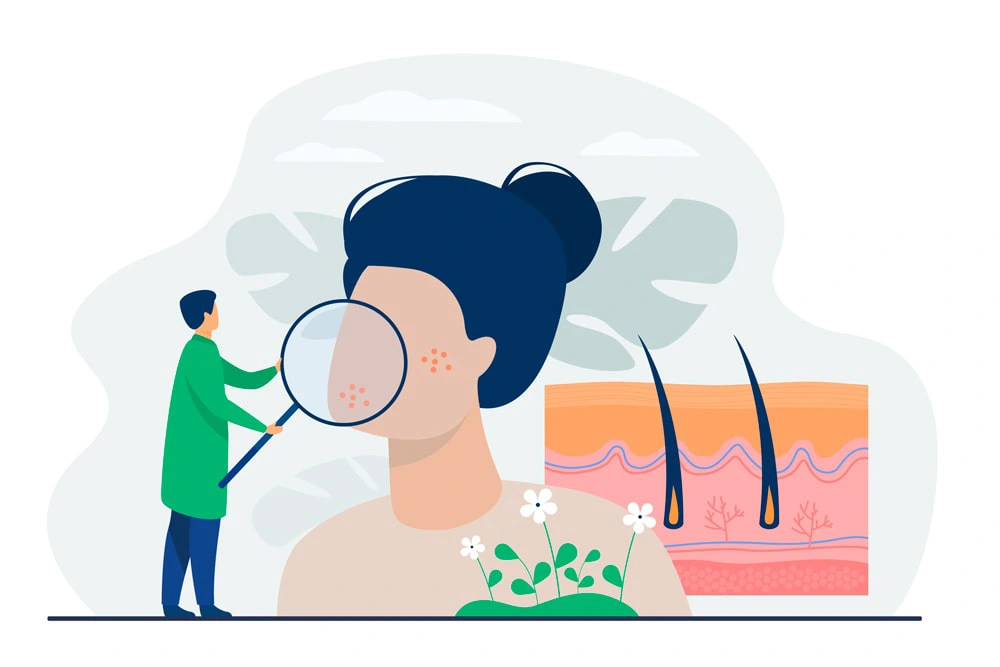 Dermatologie, dermatolog Iasi – Silva Clinic Dermatologie, dermatolog Iasi - Silva Clinic